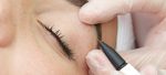 How does Electrolysis hair removal work?