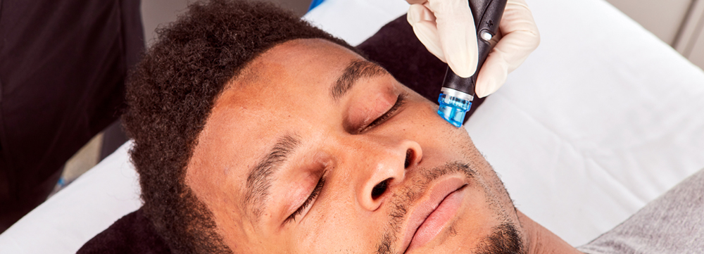 Male hydrafacials London