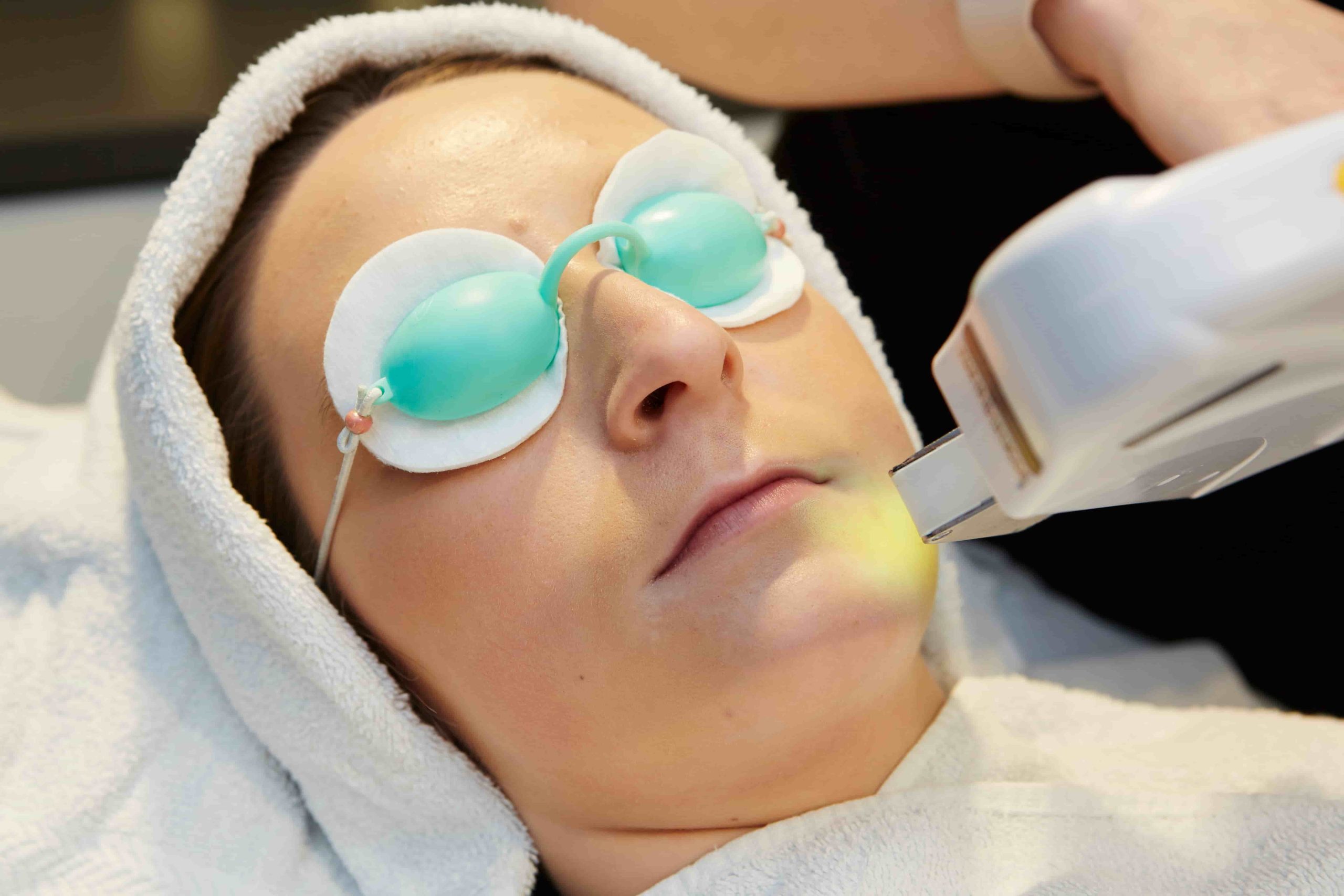 IPL Skin Rejuvenation