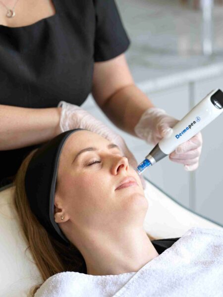 dermapen micro-needling london