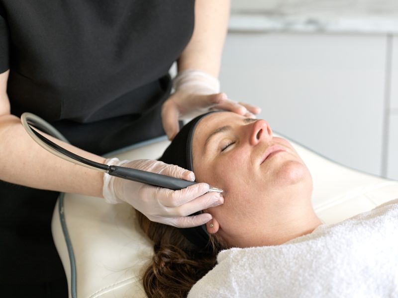 Microdermabrasion Kensington & Wimbledon