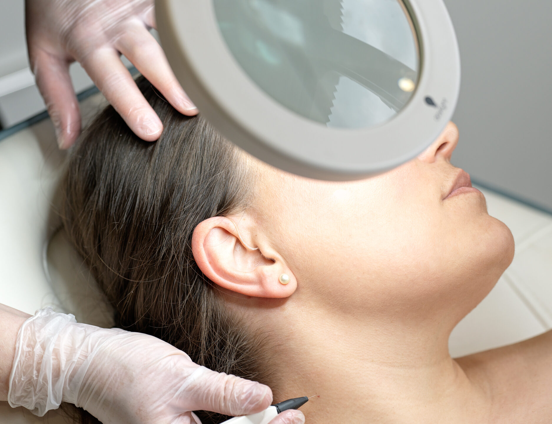 Non-surgical Skin Tightening