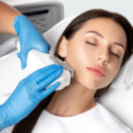 ipl hair removal battersea