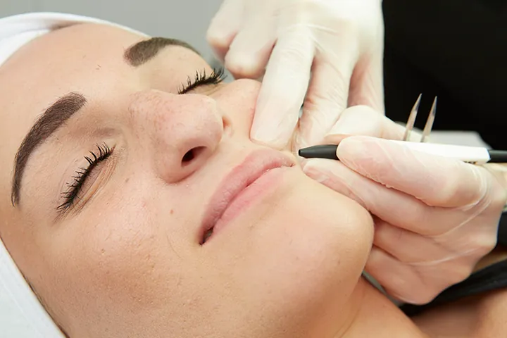 Electrolysis Hair Removal.