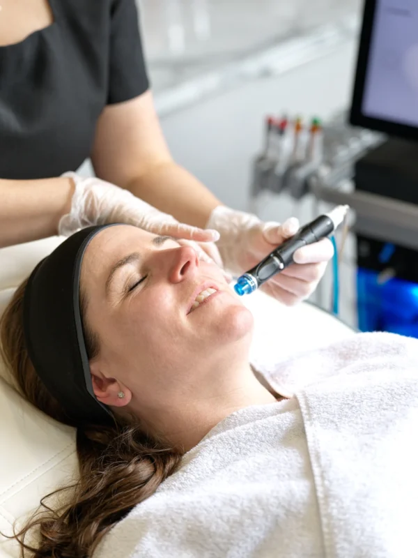 hydrafacial offer Kensington